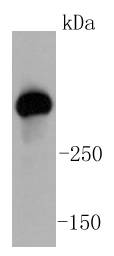 ATM Antibody
