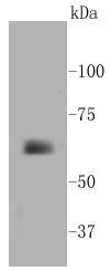 MMP14 Antibody