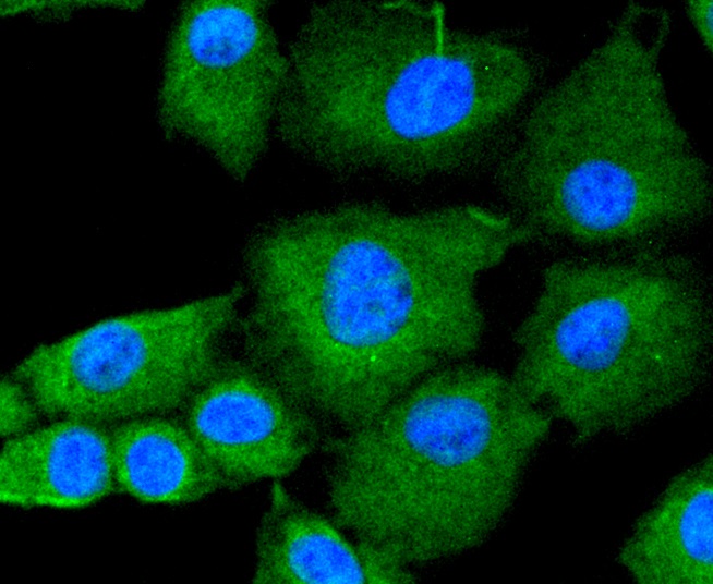 JAK2 Antibody