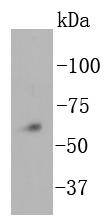 NADPH oxidase 4/NOX4 Antibody
