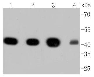 alpha smooth muscle Actin Antibody
