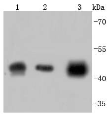 alpha smooth muscle Actin Antibody