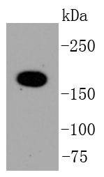 Topoisomerase Ⅱ alpha Antibody