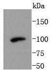 PI 3 Kinase Class 3 Antibody