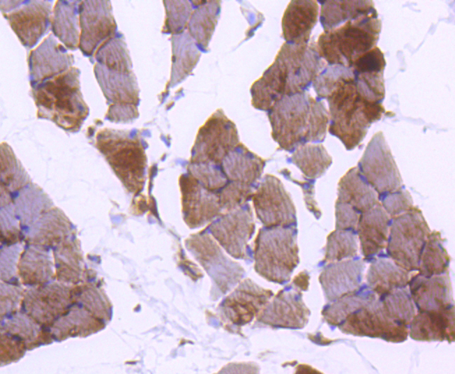 Plectin Antibody
