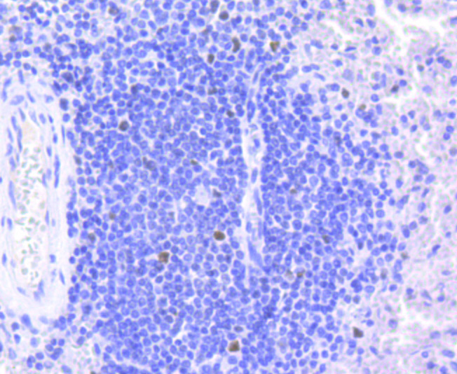Rb Antibody