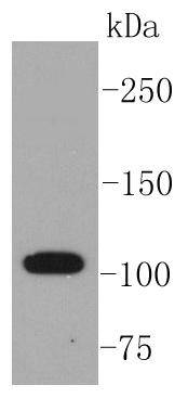 ABCG1 Antibody