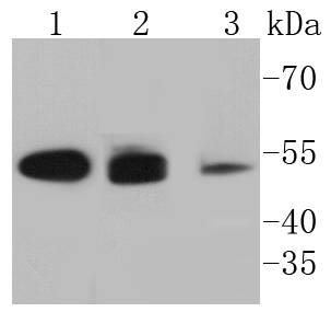 Cytokeratin 8+18 Antibody