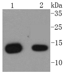 beta 2 Microglobulin Antibody