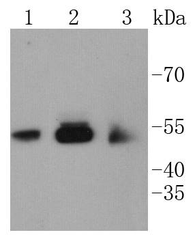 CaMKⅡ Antibody