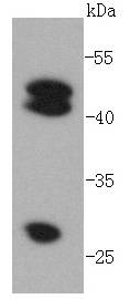 Cathepsin D Antibody