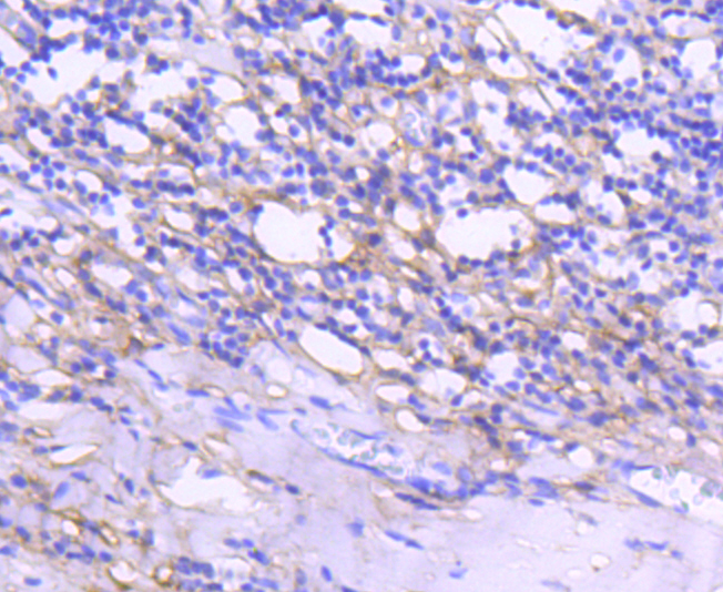 Tenascin C Antibody