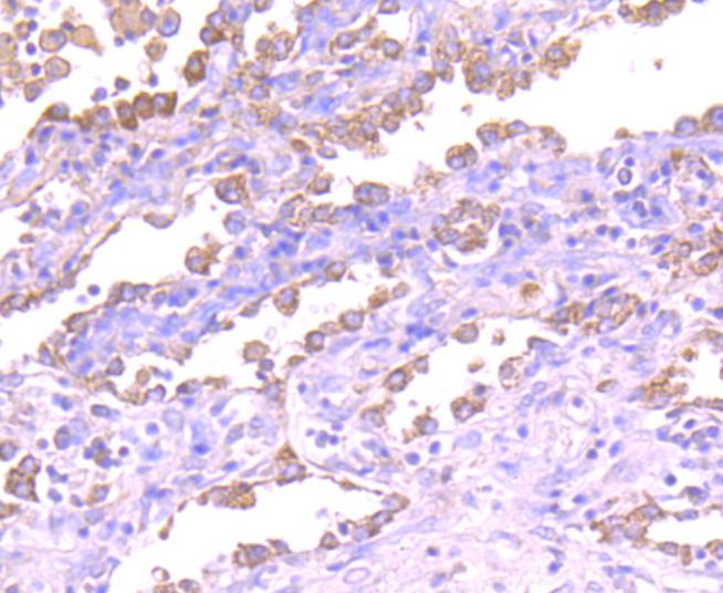 ASK1 Antibody