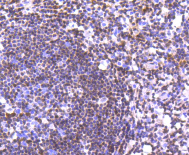 p27 KIP 1 Antibody