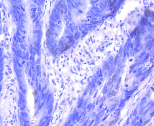 p16INK4A Antibody