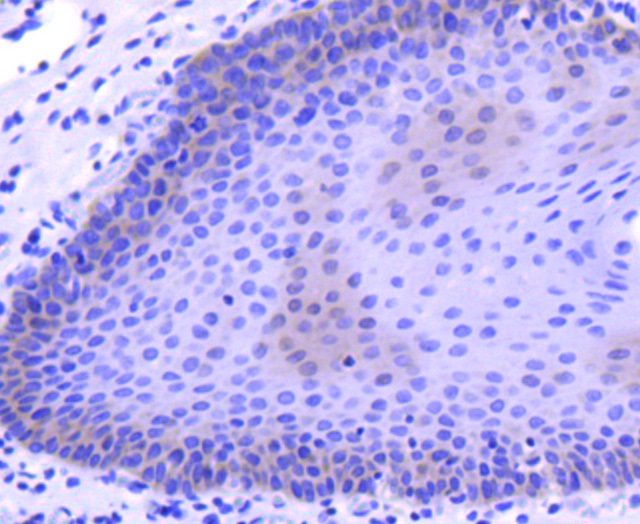 MCSF Antibody