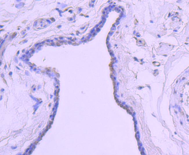 Androgen receptor Antibody