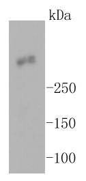 Ki67 Antibody
