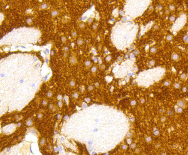 Metabotropic glutamate receptor 5 Antibody