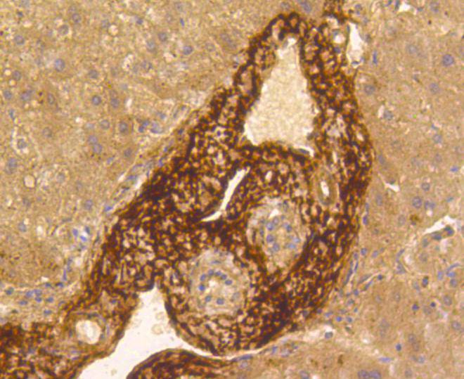 Vitronectin Antibody
