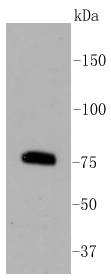 PKC beta 2 Antibody