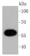 AKT1 Antibody