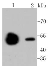 beta Ⅱ Tubulin Antibody