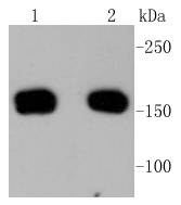 ROCK1 Antibody