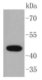 Cytokeratin 15 Antibody
