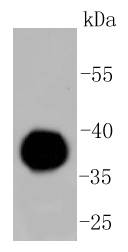 IgG4 Antibody