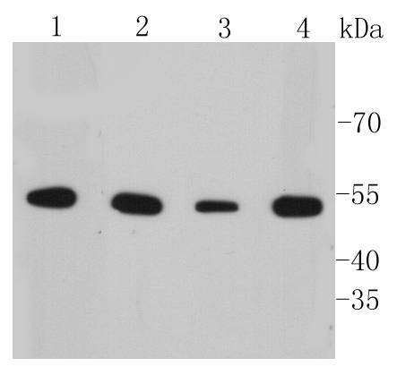 Cytokeratin 7 Antibody