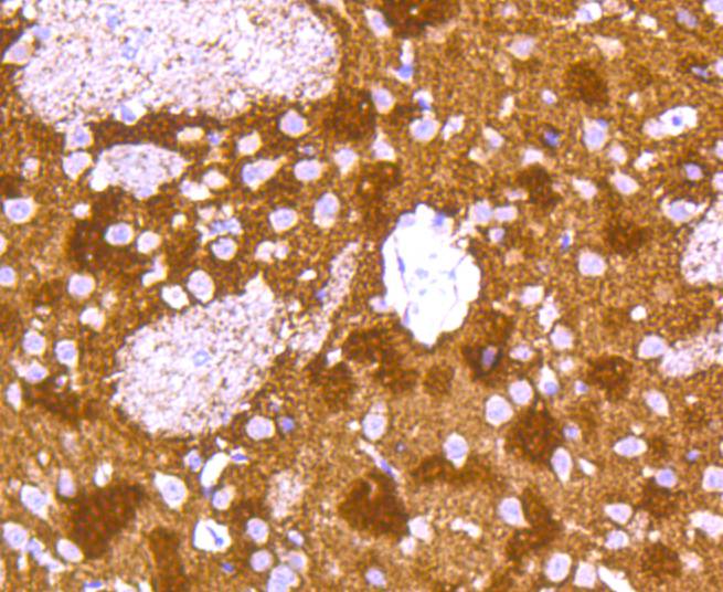 alpha+beta Synuclein Antibody