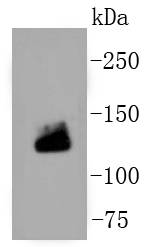 COL1A1/Collagen Ⅰ Antibody