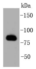 GRK2 Antibody