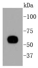 Cytokeratin 10 Antibody