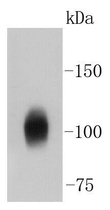 Sodium Potassium ATPase Antibody