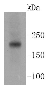 Tuberin Antibody