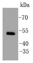 Estrogen Related Receptor alpha Antibody