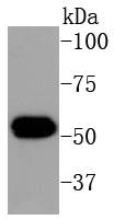 Cytokeratin 16 Antibody