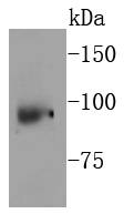 p95 NBS1 Antibody