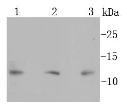 S100 beta Antibody