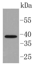 Islet 1 Antibody