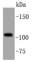 PI3-kinase p110 subunit beta Antibody