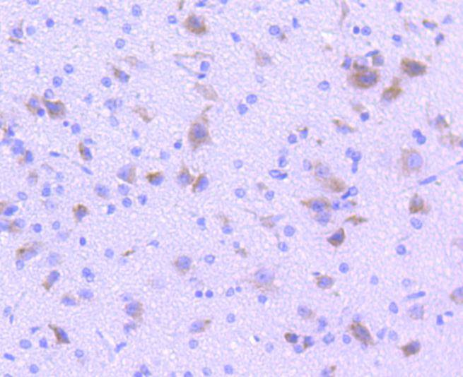 Tryptophan Hydroxylase 1 (TPH1) Antibody
