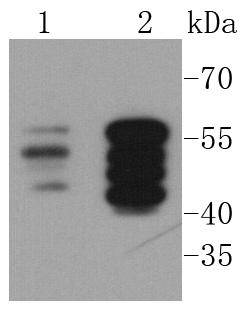 Vimentin Antibody