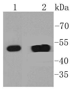 Cytokeratin 14 Antibody