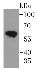 Cytokeratin 5 Antibody
