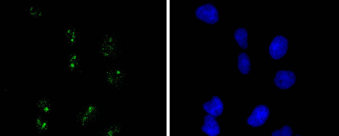 Wilms Tumor Protein Antibody