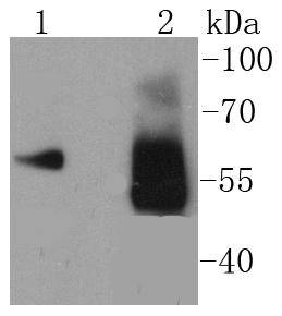 Asparagine synthetase Antibody