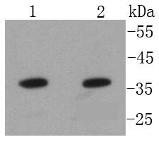 Annexin A10 Antibody